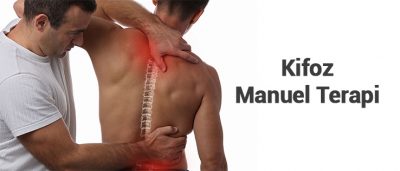 kifoz manuel terapi